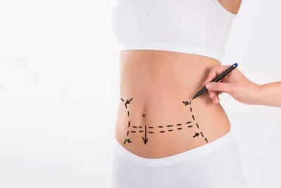 Tummy Tuck Surgery in Delhi at Affordable Cost - Delhi Other