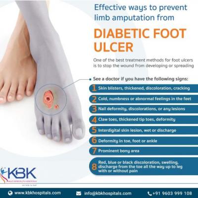 Diabetic Foot Care Clinic in Hyderabad - Hyderabad Health, Personal Trainer