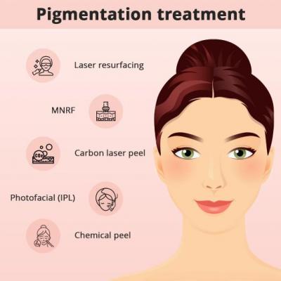 pigmentation treatment cost in Hyderabad - Hyderabad Health, Personal Trainer
