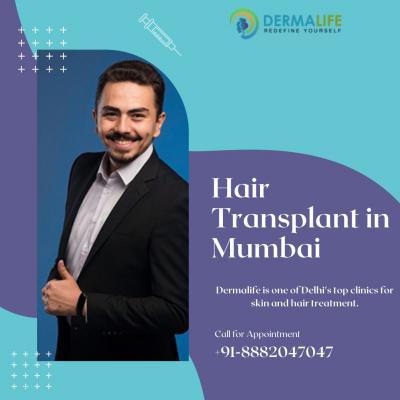 HAIR TRANSPLANT IN MUMBAI - Delhi Health, Personal Trainer