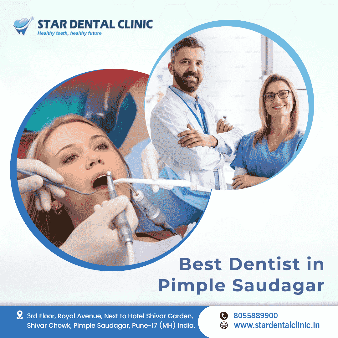 Best Dentist in Pimple Saudagar - Star Dental Clinic - Pune Health, Personal Trainer