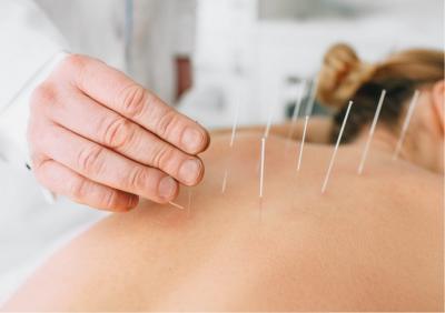 Get Pain Relief by Dry Needling - Best Massage Melbourne CBD - Melbourne Health, Personal Trainer