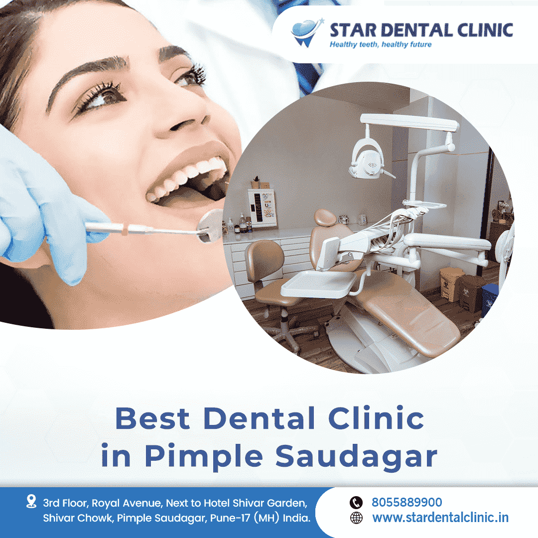 Experience The Best Dental Care in Pimple Saudagar | Star Dental Clinic