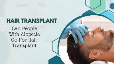 Best Hair Transplant in Delhi