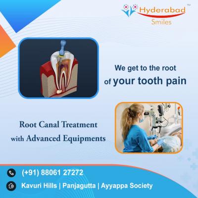  Pain-Free Root Canal Treatment in Hyderabad, Unveiled at Hyderabad Smiles in Madhapur - Hyderabad Health, Personal Trainer