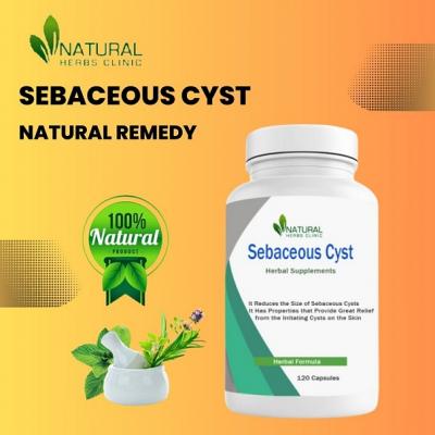 Home Removal of Sebaceous Cyst Solution - Chennai Health, Personal Trainer