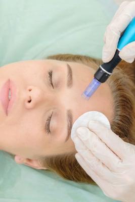 Skin Needling Perth - Perth Other