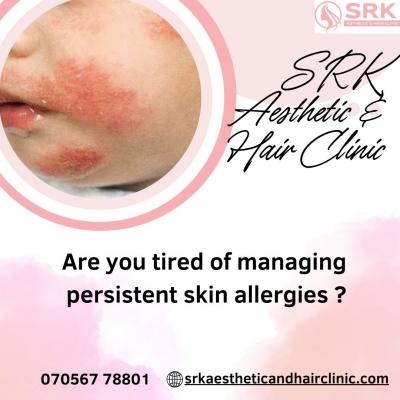 The Importance of Regular Skin Check-ups with a Dermatologist in Sonipat - Other Health, Personal Trainer