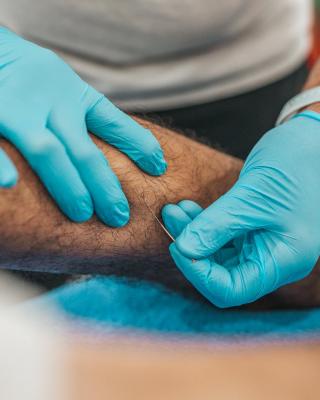 Top-Rated Dry Needling Therapy and Acupuncture Clinic in New South Wales - Sydney Professional Services