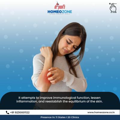 Experience Holistic Healing with the Best Homeopathy Doctor in Kolkata for Psoriasis Treatment - Kolkata Health, Personal Trainer