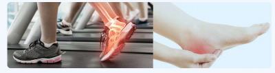 Calcaneal Heel Spur Treatment | Boynerclinic.com - Delhi Health, Personal Trainer