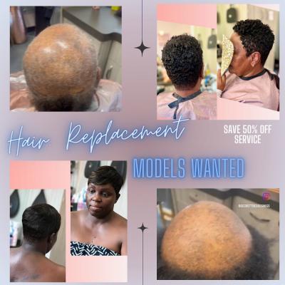 Non-Surgical hair replacement - New York Health, Personal Trainer