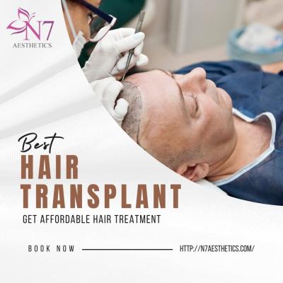 Hair Transplant in Chandigarh - Chandigarh Professional Services