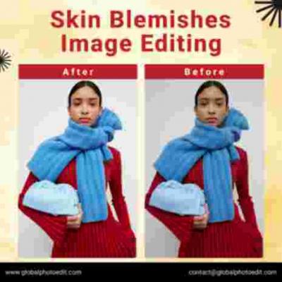 Professional Removal Skin Blemishes Image Editing Company - Los Angeles Events, Photography