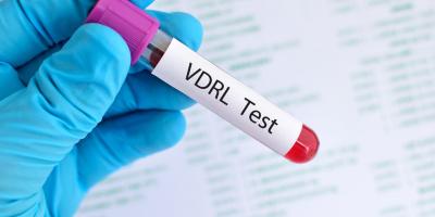 VDRL Serum Test at Agilus Diagnostics