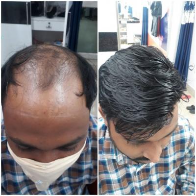 Hair clipping in Cuttack