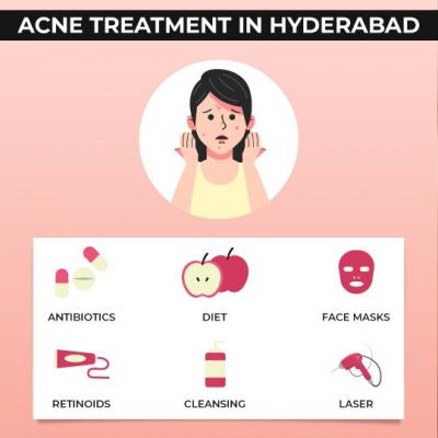 acne treatment cost in Hyderabad - Hyderabad Health, Personal Trainer