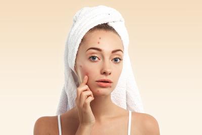 Transform Your Skin With Best Acne Treatment in Richmond Hill, Ontario at Glow Med Clinic