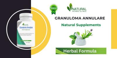 Unlock Radiant Skin: Best Treatment for Granuloma Annulare - Clinical Results - Chennai Health, Personal Trainer