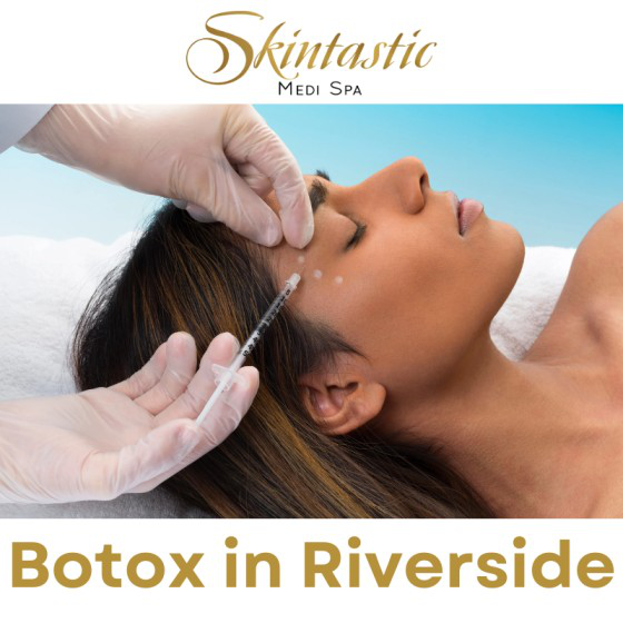 Experience Timeless Beauty with Botox in Riverside at Skintastic Medi Spa  - Los Angeles Professional Services