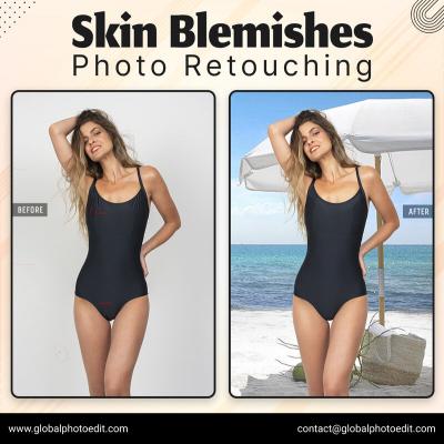 Remove Skin Blemishes Image Retouching Company