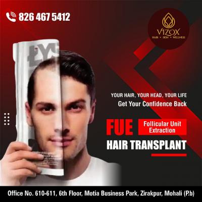 Get Natural Hair Restoration at the Best FUE Hair Transplant Clinic in Chandigarh