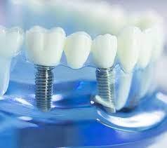 Implant Dentistry in Marlboro, NJ