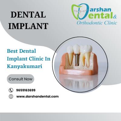 Dental Implant Clinic In Kanyakumari | Dental Implant Clinic - Chennai Other