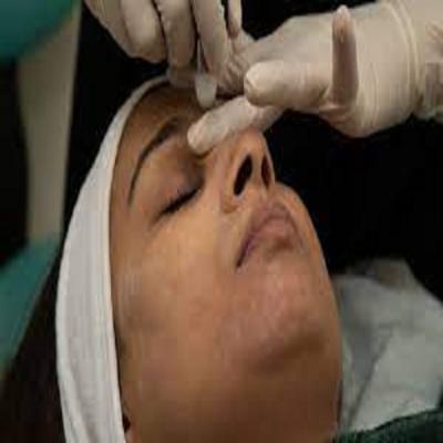 Oxygen Facial Treatment - Other Other