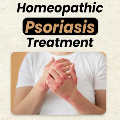 Homeopathic medicine for psoriasis - Gurgaon Health, Personal Trainer
