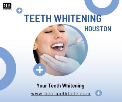 Is Teeth Whitening in Houston for a Brighter Smile?