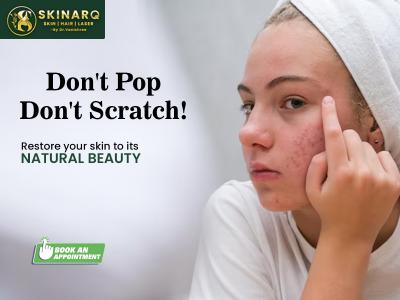 Laser Treatment For Acne Scars in Pune | Best Laser Treatment For Acne Scars Specialist | Skinarq - Pune Health, Personal Trainer