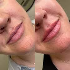 Best Lip Blush in Hamilton - Toronto Professional Services