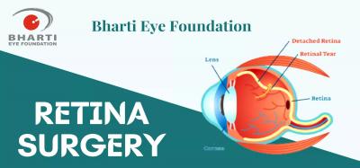 Best Retina Surgery Hospital in Delhi