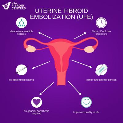 Liberty from Fibroids: Explore UFE meaning at USA Fibroid Centers - New York Health, Personal Trainer
