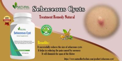 Home Removal of Sebaceous Cyst - Chennai Health, Personal Trainer