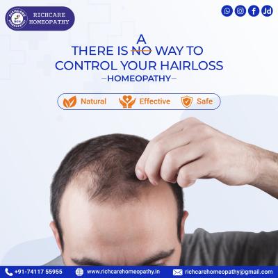  Signs  symptoms of Hair Fall |  Homeopathy Treatments in Bangalore 