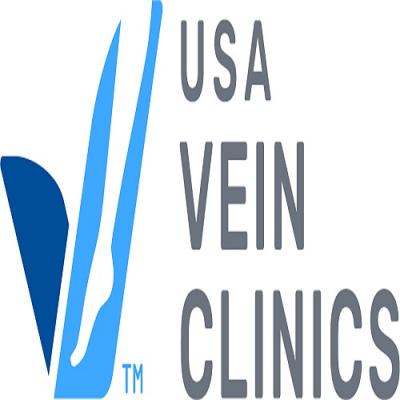 Varicose Vein Discomfort and Early Intervention Strategies - New York Health, Personal Trainer