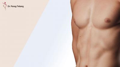 Gynecomastia Surgery in Dubai