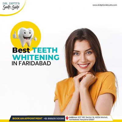 Best teeth whitening in faridabad