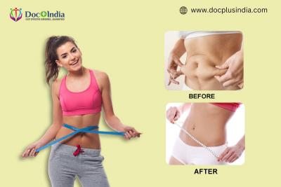 Liposuction Clinic | Surgery Cost in Hyderabad - Docplus India 