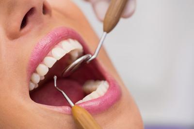 Top Reasons Why Dental Crowns in Preston Are a Smart Choice