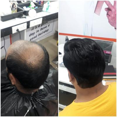Best Hair Treatment in Bhubaneswar