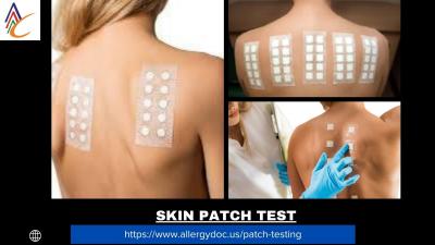 Association with reputed care center is important for best skin patch test