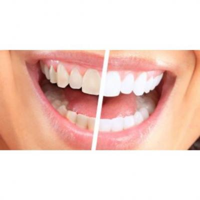 General Dentistry Treatment - Other Other