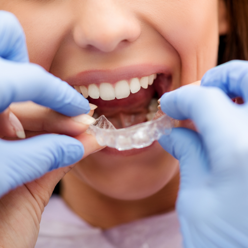Looking for the Best Invisalign Dentist in Kolkata? Step in at Mission Smile Dental Care Clinic!