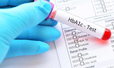Accurate & Affordable Sugar Test HbA1c Test in India - Manipal TRUtest