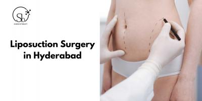 Liposuction Surgery in Hyderabad - Hyderabad Health, Personal Trainer