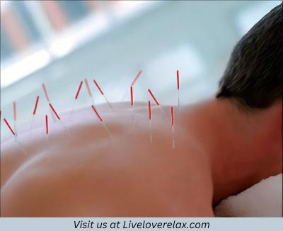 Unlock Healing with Best Acupuncture in Austin - Austin Professional Services