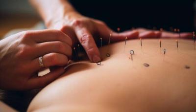 CT Clinic Dubai: Holistic Acupuncture for Health and Vitality